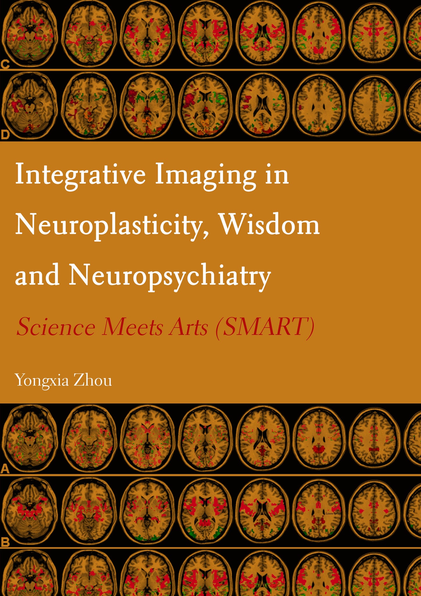 Integrative Imaging in Neuroplasticity, Wisdom and Neuropsychiatry: Science Meets Arts (SMART)